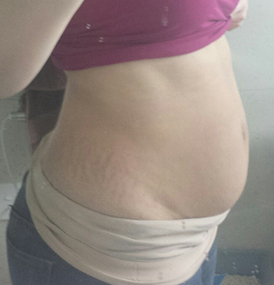 Belly Wrap