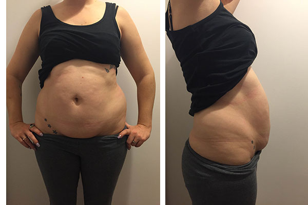Belly Wrap Review
